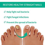 Fast Nail Fungus Treatment Serum | Nail Repair Essence for Fingernails & Toenails | Natural Nail Care Formula