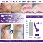 TIMILK Scarvanisher Scar Gel 30g | Advanced Scar & Stretch Marks Removal Cream | Fast-Absorbing Skin Repair Gel
